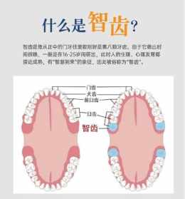 长智齿的迷信说法 长智齿佛教的缘由