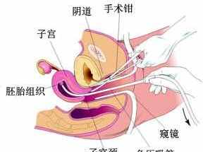 佛教中打胎会怎么样 佛教讲打胎