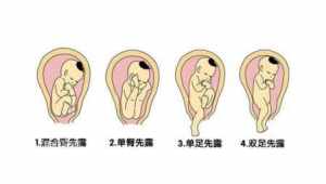 佛教说胎儿停育 佛说怀孕胎停