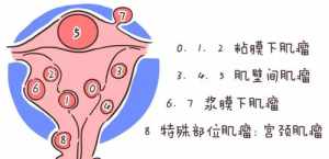 妇科精神病是什么病 妇科病精气佛教