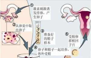 佛教说试管婴儿和父母的因缘 试管婴儿佛学问答