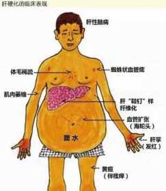 肝腹水佛法 肝腹水方