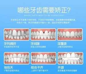 念佛经矫正牙齿 念佛牙齿修复了的真实