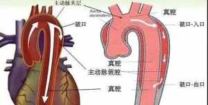 血管病佛教 佛教治心脑血管疾病